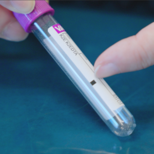 thumbnail - different types of blood tubes