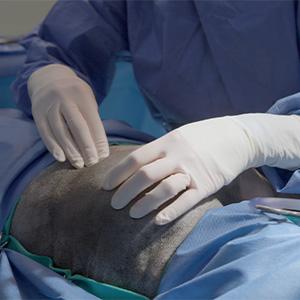 thumbnail - mass under the scapula of a canine