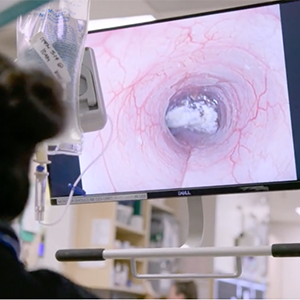 thumbnail - tracheal foreign body removal with a scope